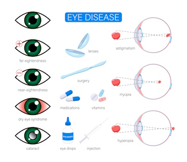 Eye diseases